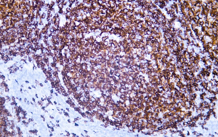 Anti-CD20 Antibody (3J782)