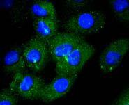 Anti-CD14 Antibody (7E908)