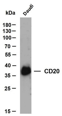 Anti-CD20 Antibody (3J782)