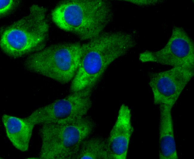 Anti-4-1BB/CD137/TNFRSF9 Antibody (9T808)