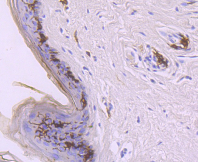 Anti-CD1A Antibody (9B433)