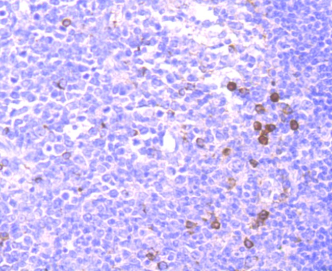 Anti-4-1BB/CD137/TNFRSF9 Antibody (9T808)