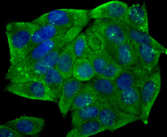 Anti-CD146/MCAM Antibody (6W862)