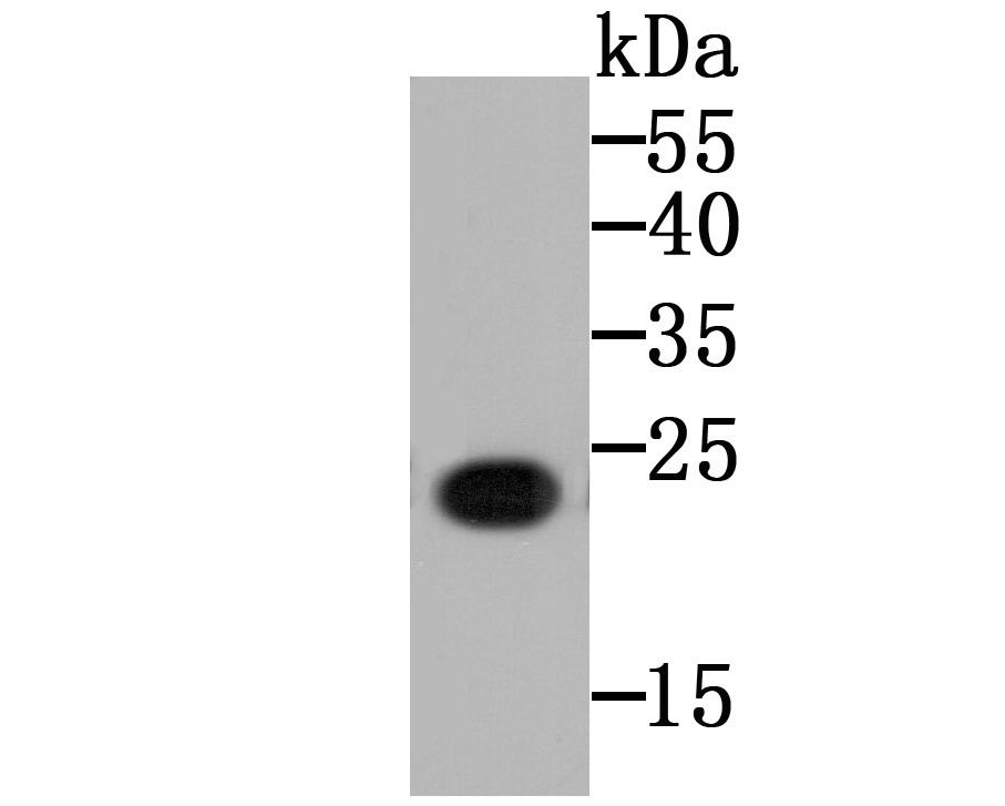 Anti-gp130/IL6ST Antibody (2B824)