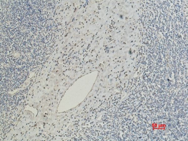 Anti-CD5 Antibody (2E235)