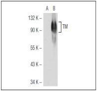 Anti-Thrombomodulin Antibody (9K199)