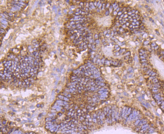 Anti-CD147 Antibody (7A20)