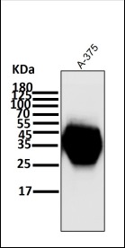 Anti-CD63 Antibody (1H895)