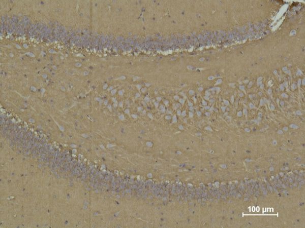 Anti-CD15 Antibody (4N938)