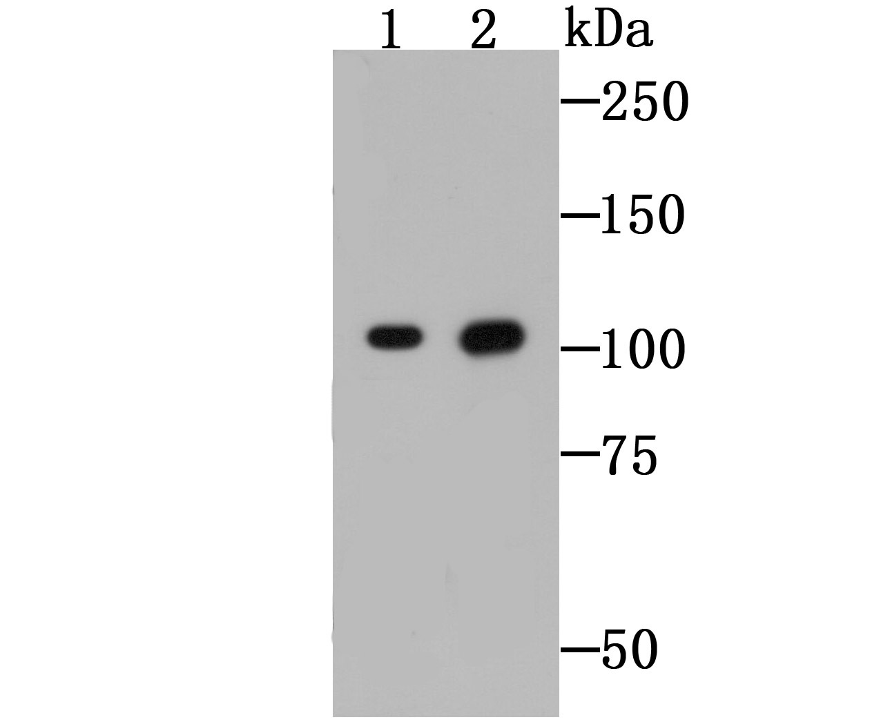 Anti-gp130/IL6ST Antibody (2B824)