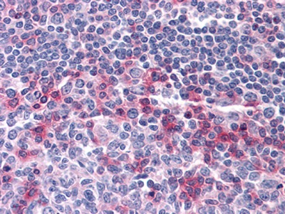 Anti-CD69 Antibody (7S617)