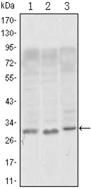 Anti-CD69 Antibody (7S617)