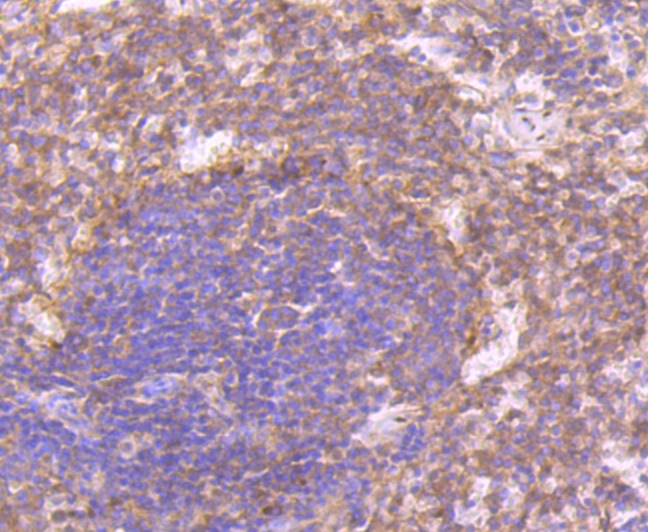 Anti-CD27/TNFRSF7 Antibody (8H198)