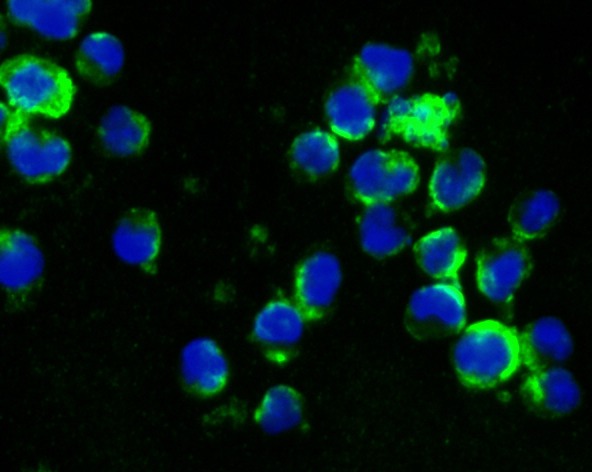 Anti-CD27/TNFRSF7 Antibody (8H198)