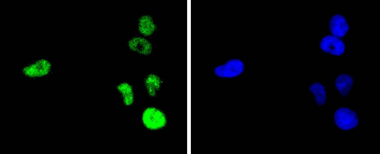 Anti-JUN Antibody (7A403)
