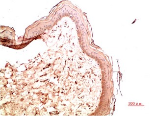 Anti-COL4A1 Antibody (9O530)