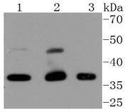 Anti-CDK9 Antibody (1M957)