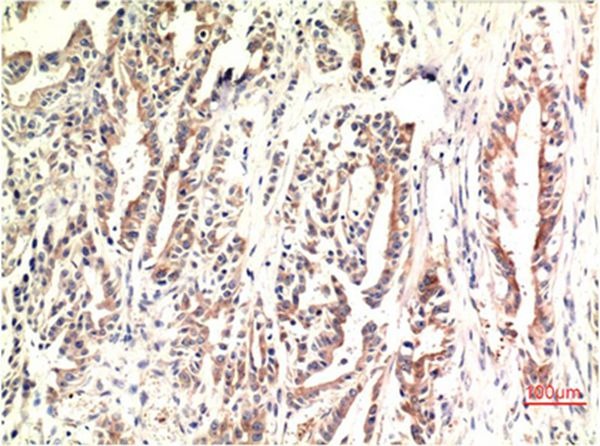 Anti-DDIT3 Antibody (2Y717)