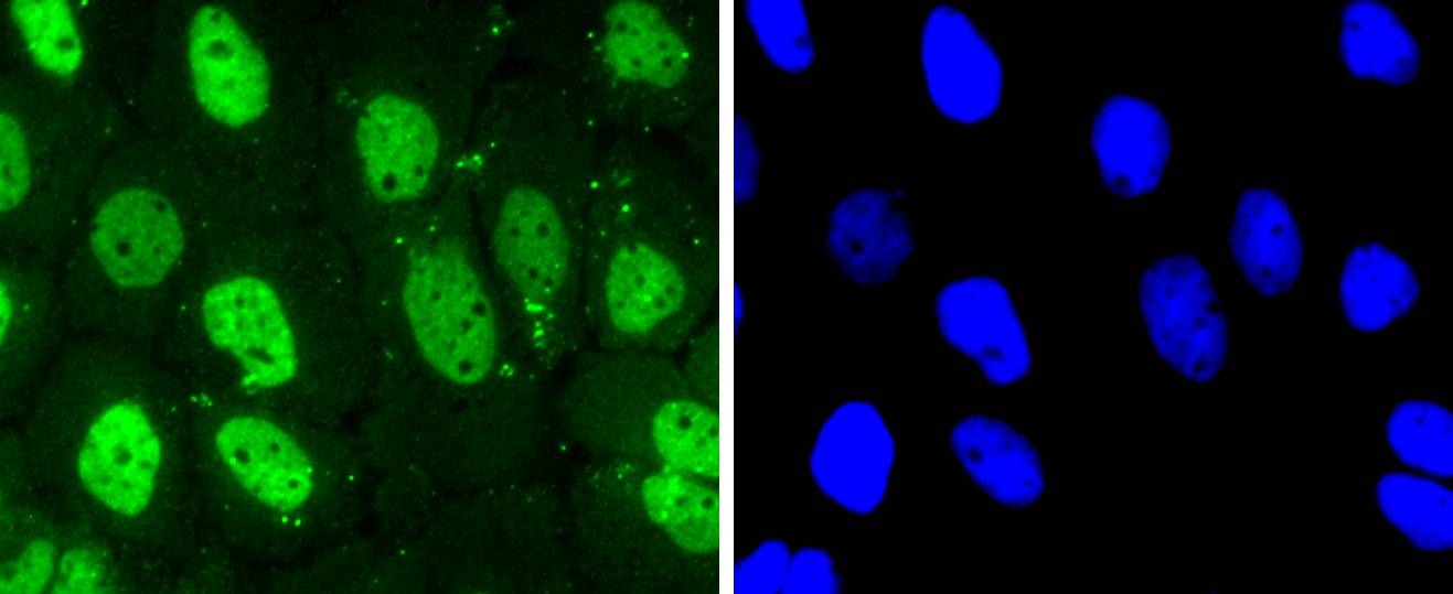 Anti-CDK7 Antibody (3Y405)