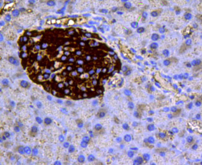 Anti-CHGA Antibody (5H899)