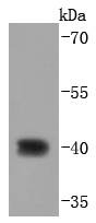 Anti-CDX2 Antibody (1N738)