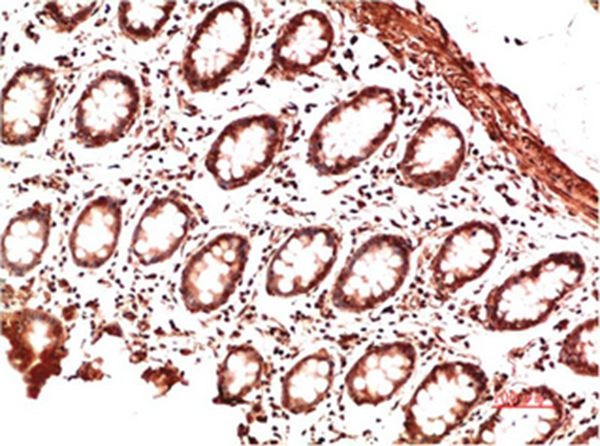 Anti-Collagen II/COL2A1 Antibody (6L401)
