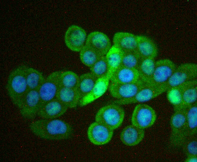 Anti-CDX1 Antibody (5H993)