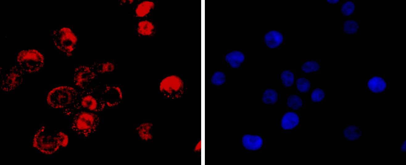 Anti-CDX2 Antibody (1N738)