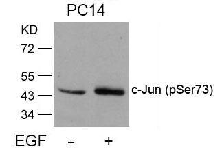 Anti-Phospho-JUN (Ser73) Polyclonal Antibody