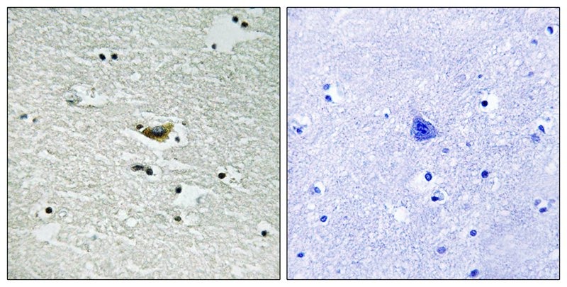 Anti-Phospho-CK1 alpha (Tyr294) Polyclonal Antibody