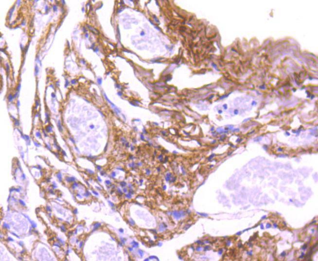 Anti-COL6A3 Antibody (4A311)