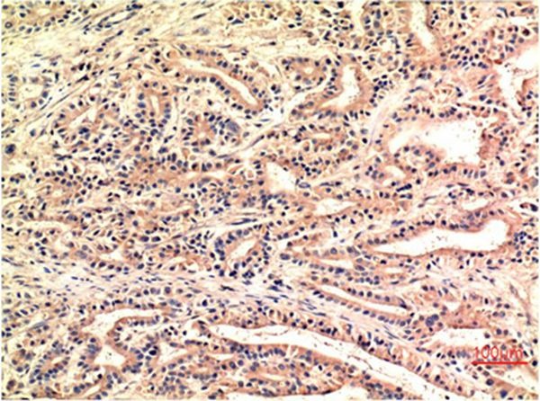 Anti-DDIT3 Antibody (6D234)