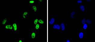 Anti-CDK9 Antibody (1M957)