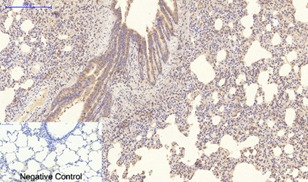 Anti-COL4A1 Antibody (8N71)