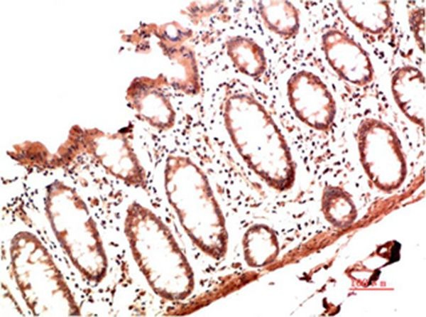 Anti-Collagen I Antibody (1G115)