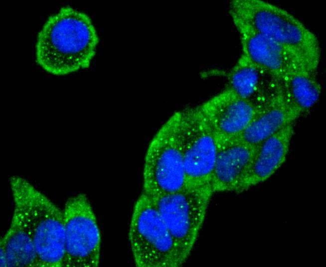 Anti-COL6A3 Antibody (4A311)