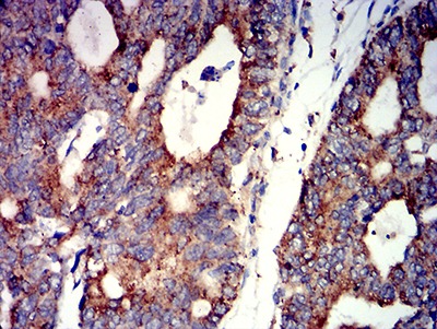Anti-CHRNA7 Antibody (5X667)