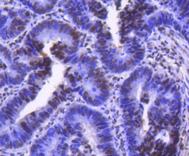 Anti-CDK9 Antibody (1M957)