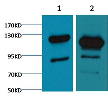 Anti-PARP1 Antibody (6J247)