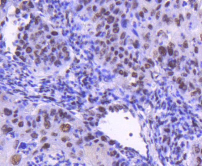 Anti-CDK9 Antibody (1M957)