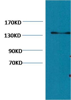 Anti-COL3A1 Antibody (7P469)