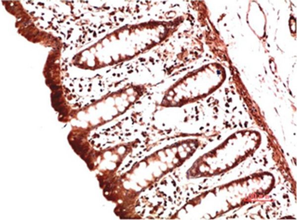 Anti-Collagen II/COL2A1 Antibody (6L401)