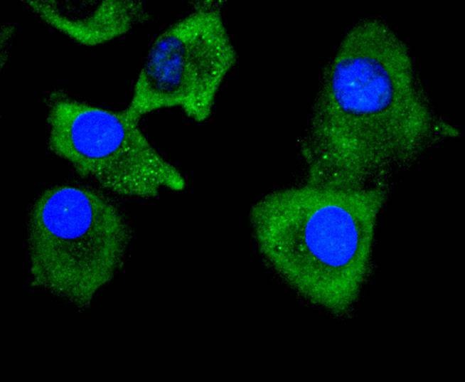 Anti-COL6A3 Antibody (4A311)