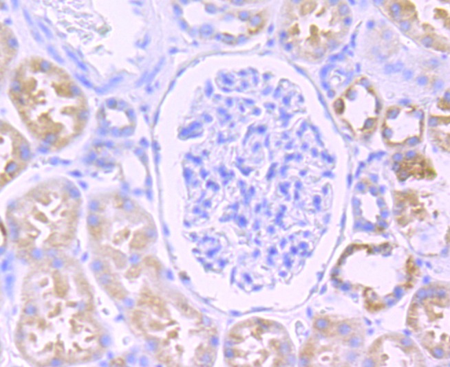 Anti-Citrate Synthase Antibody (7Y580)