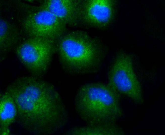 Anti-COL17A1 Antibody (5Q412)