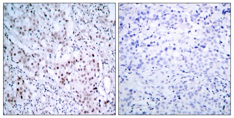Anti-Phospho-JUN (Ser63) Polyclonal Antibody