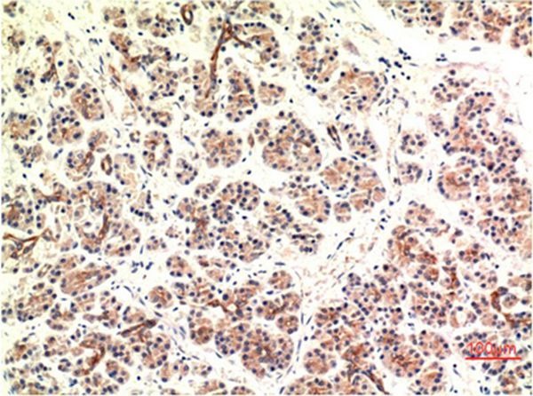 Anti-DDIT3 Antibody (2Y717)