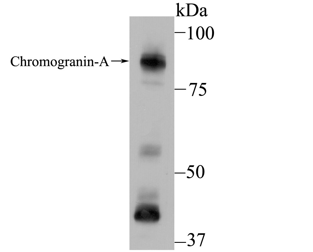 Anti-CHGA Antibody (5H899)