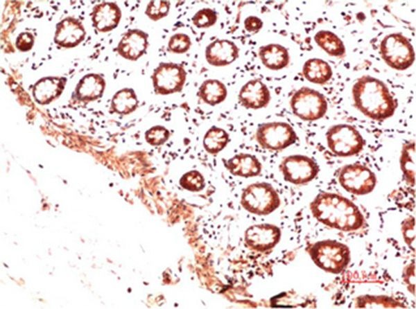 Anti-Collagen II/COL2A1 Antibody (5B231)