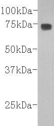Anti-Complement C3 Antibody (8A723)